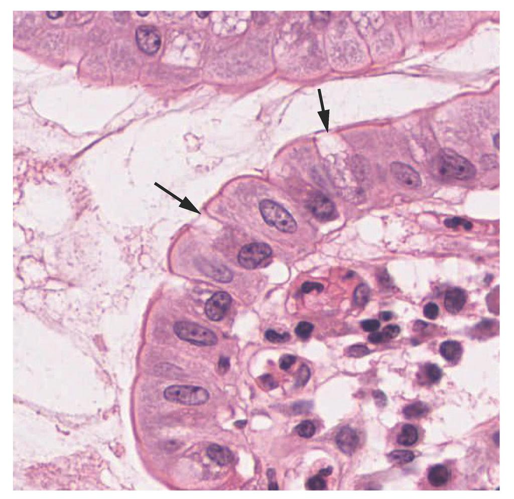 (b) The arrows in this micrograph point to the mucous-secreting goblet cells.