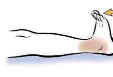 In-Bed Exercises The following exercises can be done in bed. Some help improve blood flow.
