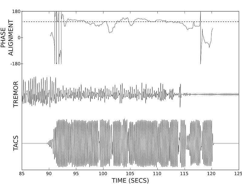Identification of the optimal Phase-Delay for tremor