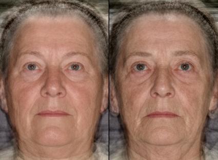 Danish Twin Register in Odense Left hand image represents twins who looked younger for their age (average perceived age 64, range 57-69) than those represented by right hand image