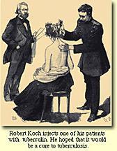 Robert Koch s Therapeutic TB vaccine 1890: Purified Tuberculin