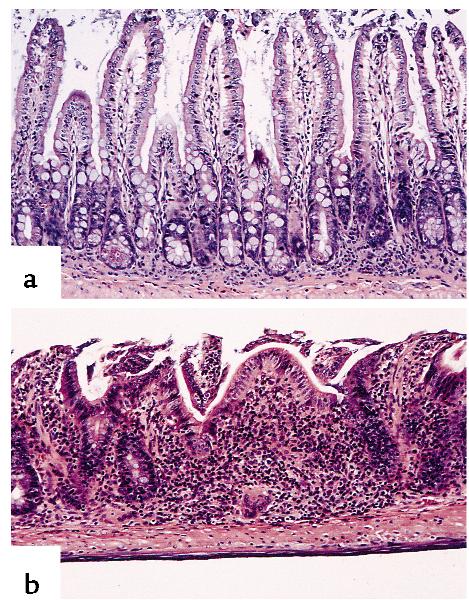 terminal ileum and exhibits histopathology that is very similar to the spontaneous disease seen in the SAMP1/Yit mice.
