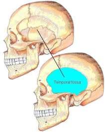 Lec [5] / Temporal fossa : Borders of the Temporal Fossa: Superior: Superior temporal line. Inferior: gap between zygomatic arch and infratemporal crest of sphenoid bone.