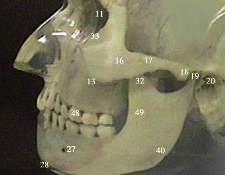 condyle, 20 external auditory meatus, 21 first cervical vertebra (atlas), 22 second cervical vertebra (axis), 23 third cervical vertebra, 24 fourth cervical vertebra, 25 mandibular foramen and