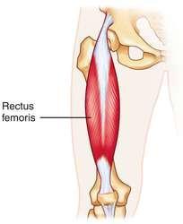 Muscles: Rectus Femoris O: Anterior inferior iliac spine I: Patella via quadriceps tendon & tibial tuberosity via patellar ligament A: Extension at the knee and flexion at the hip N: Femoral nerve R: