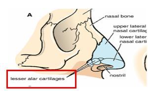 1- External Nose Has 2 main parts, cartilaginous and bony Cartilaginous framework: - Septal cartilage (middle wall) - Lateral nasal cartilage (lateral wall) divides into: 1-upper lateral cartilage