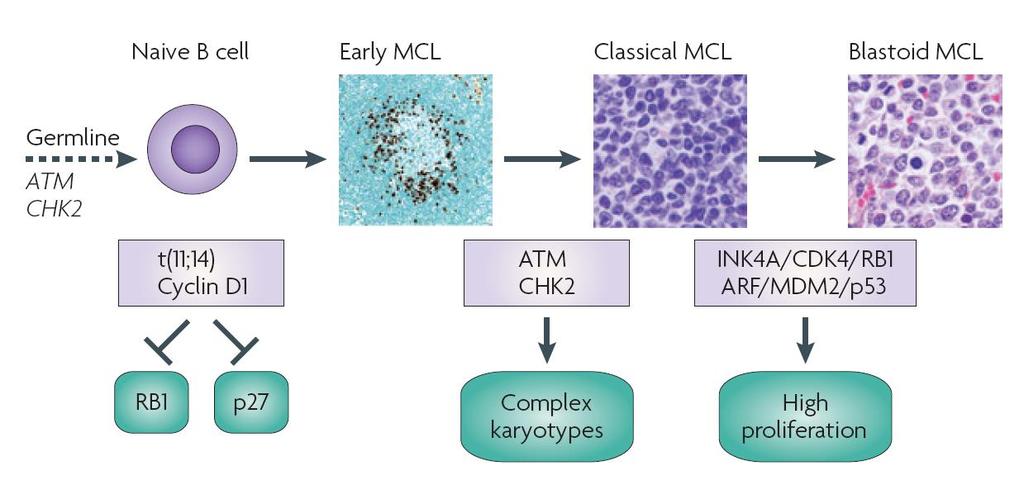 MCL: a spectrum of disease