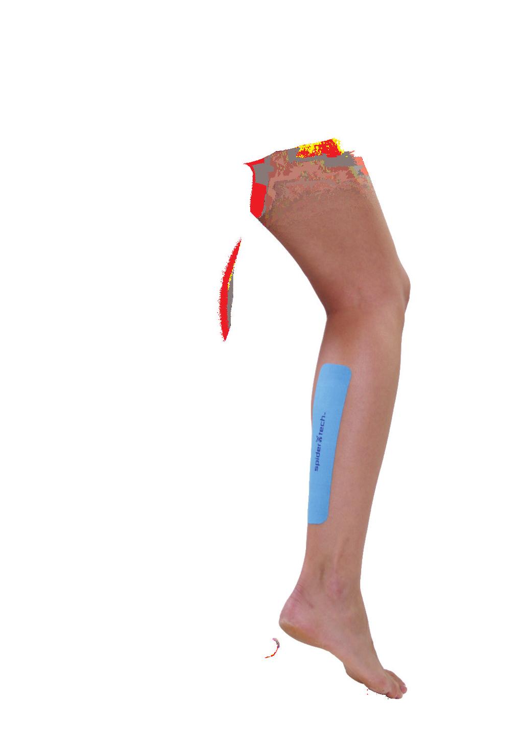 CALF The Calf Tennis Application is designed to improve your balance, stability and ankle motion.