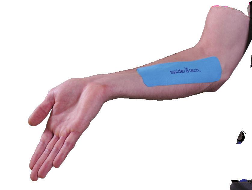 ELBOW The Elbow application is designed to help relieve the forearm tightness that causes Tennis