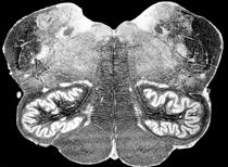 Vestibulospinal tract: balance (axial muscles); automatic postural adjustments Brain stem nuclei Superior