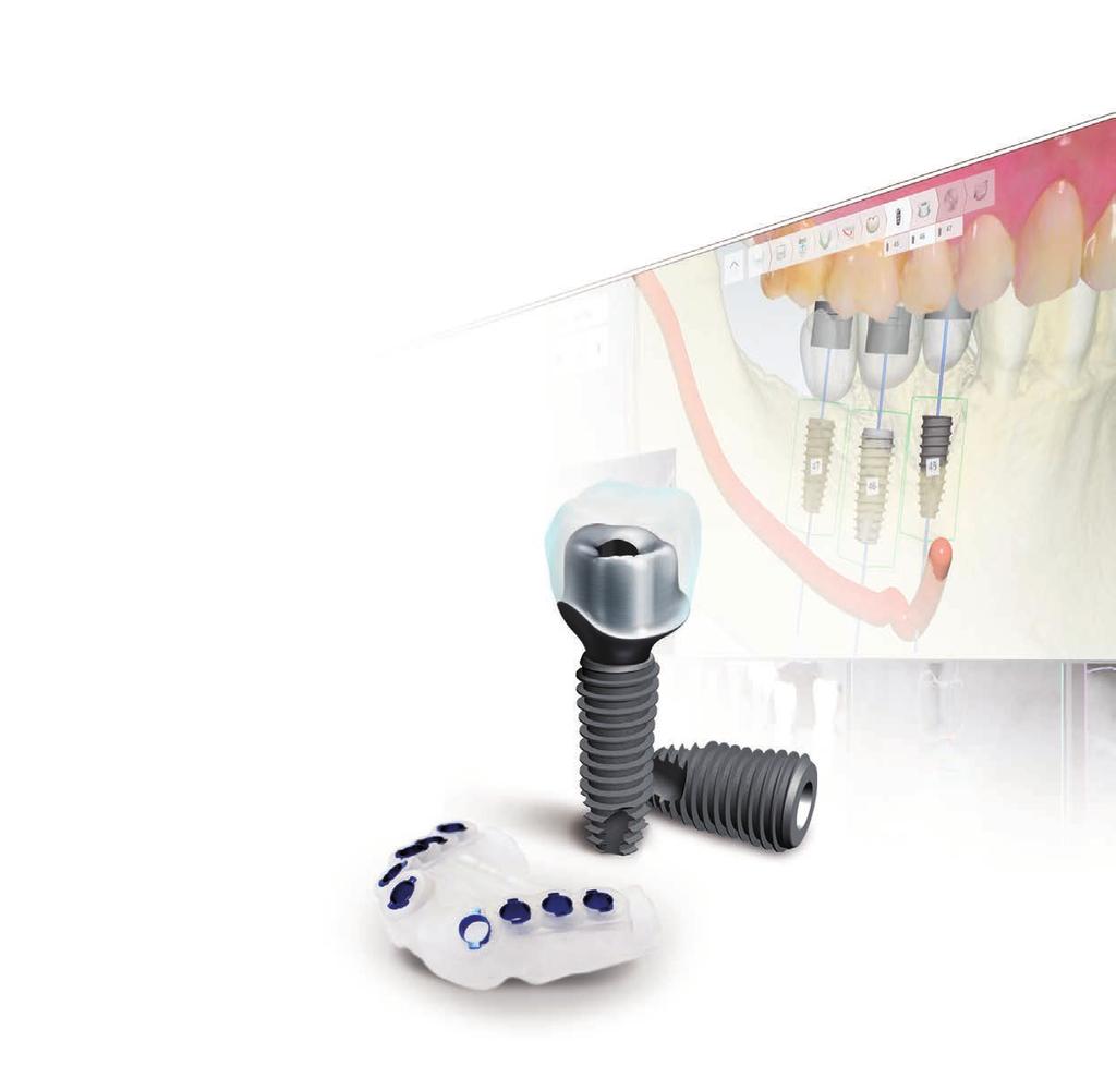 The most Advanced Implant Surgery 3D Simulated Surgery makes it easier and faster!