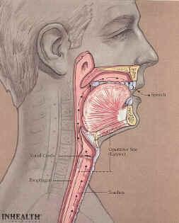 Throat Cancer of Larynx (voice box) and