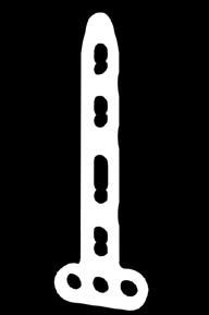 11.109.03 Distal Radius Volar Juxta-articular Locking Plate Used for distal radius fracture, esprcially for osteoporotic or comminuted fracture conditions. Screw: Head Part 11.109.61 2.