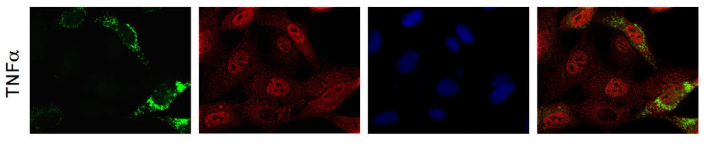 NLRX1 NF-κB p65 DAPI Merge NLRX1/NF-κB p65 Supplementary Figure 5: HeLa cells grown on glass coverslips were transfected overnight with NLRX1 expression vector and infected with Shigella or