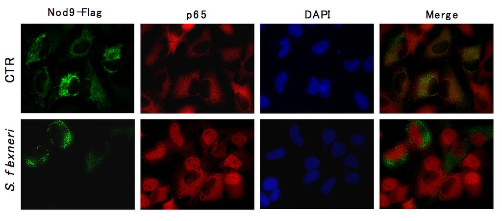 NLRX1 over-expressing cells were stained using a monoclonal anti-flag antibody, and a polyclonal anti-nf-κb p65 antibody was used to assess the cellular localization of this NF-κB subunit.