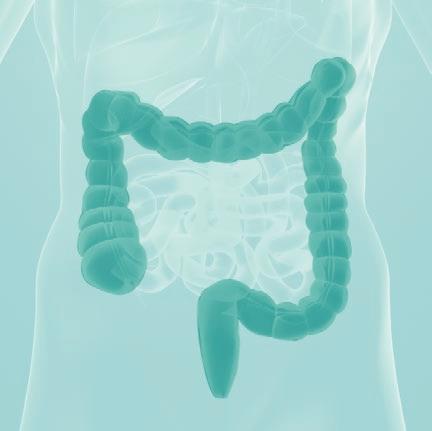 Colonoscopy is a visual examination of the lining of the large bowel (colon) with intravenous sedation.