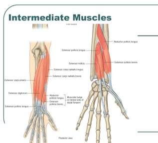 Intersection Syndrome Outcropper muscles of 1 st extensor compartment muscles