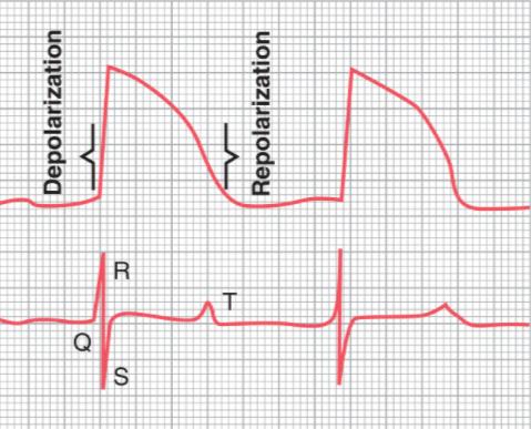 Relation of the Monophasic Action Potential of Ventricular Muscle to the QRS and T Waves in the Standard Electrocardiogram.
