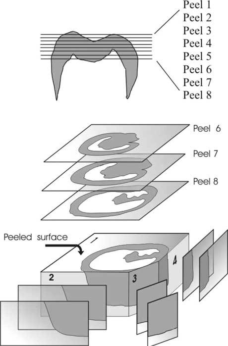 The acetate peel technique described here provides the researchers with a rapid way of preparing a large number of sequential, replicas from an undecalcified, but etched tooth surface.