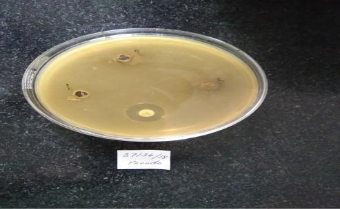 Escherichia coli Resistant 19 mm -- 2