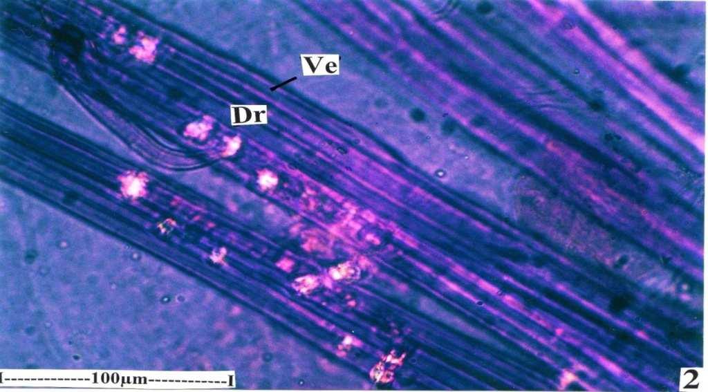 2. Calcium oxalate crystal: Sphaero crystals, diffuse in distribution and occur in the mesophyll tissue and may be the associated with veins.