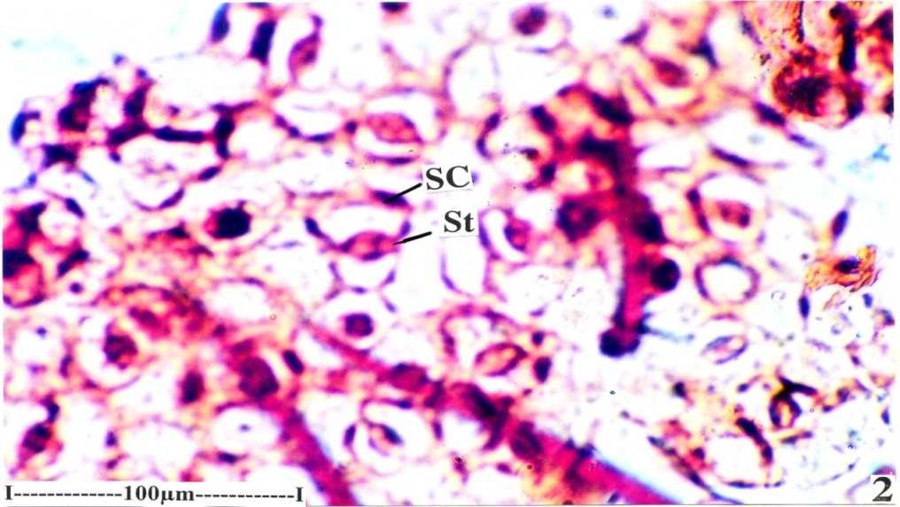 Fig G: Fragments of abaxial epidermis with stomata Where, SC St Subsidiary cells Stoma Physiochemical analysis: Air dried material was used for quantitative determination of phytochemical values.