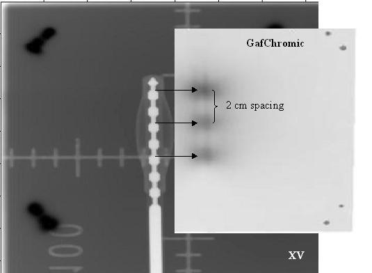 66 Hiatt et al.: EB System Commissioning 66 FIG. 8. Source linearity. F. Marker/source position coincidence In the film scanning software, the staple positions were used to register and superimpose the films.