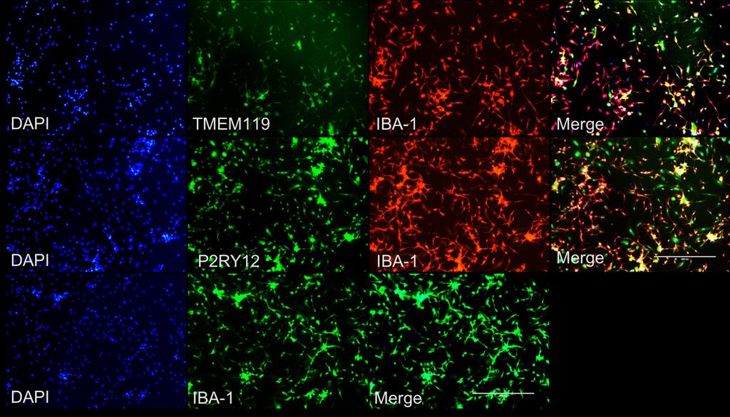 Human ipsc-derived Microglia