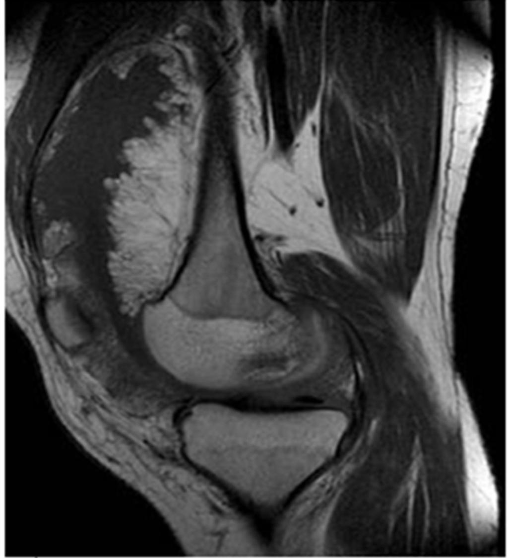 Fig. 4: T1 sagittal image showing