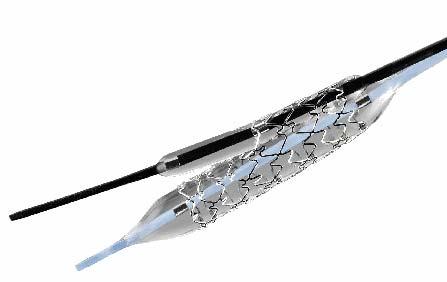 Invatec Twin-Rail Design Summary Stent Platform ¾ Closed Cell design ¾ Variable Stent Geometry ¾ Adequate scaffolding of main vessel and side branch ostium
