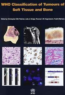 Sarcoma heterogeneity Adipocytic tumours Well differentiated / dedifferentiated liposarcoma Myxoid / round cell liposarcoma Pleomorphic liposarcoma Fibroblastic /myofibroblastic tumours Fibromatosis