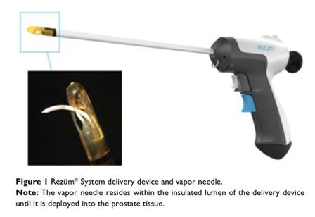 Convective water vapour + RF current (thermal)? Reduced risk ejaculatory & ED & MIT / day procedure Disposable consumable cost to patient $2000 Bias / Company; Rezūm System (NxThera Inc.