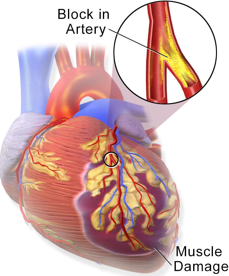 Vasoconstriction of specific arterioles diverts blood to important tissues Veins constrict to divert blood volume to