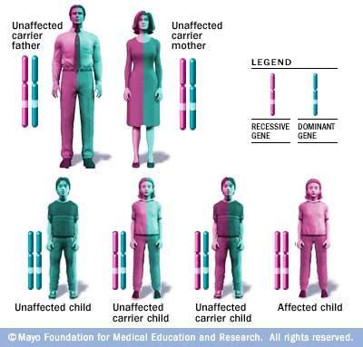 INHERITANCE PATTERN The gene mutation associated with Krabbe disease only causes the disease if two mutated copies of the gene are inherited.