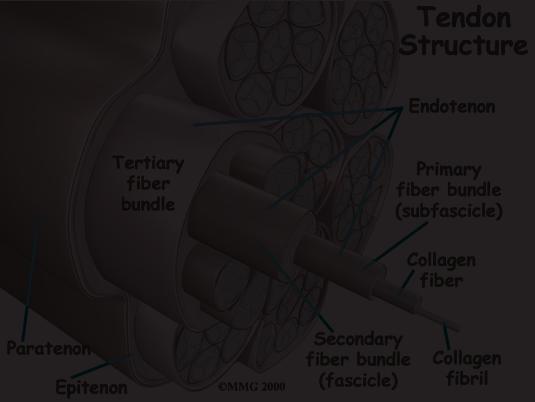 Degeneration in a tendon usually shows up as a loss of the normal arrangement of the fibers of the tendon. Tendons are made up of strands of a material called collagen.
