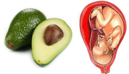 CONSTIPATION - HEMORRHOIDS Diet Recommendation Avocado Sweet