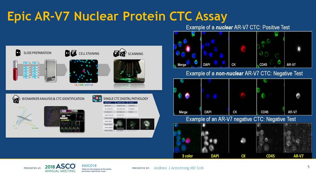 Epic AR-V7 Nuclear Protein CTC Assay Presented