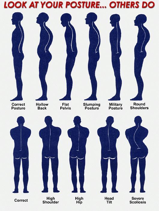 Contributing Factors Poor posture The best approach is try to maintain the back in its natural S shaped curved.