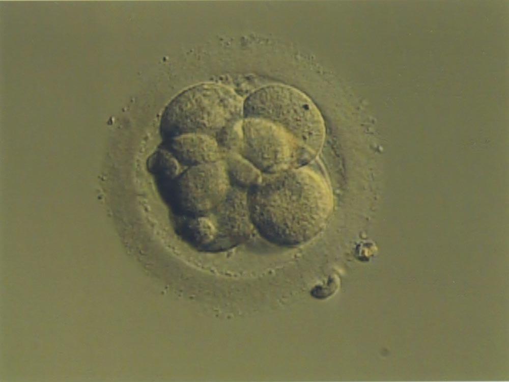Preparing Embryo With Equilibrum(ES) Solution