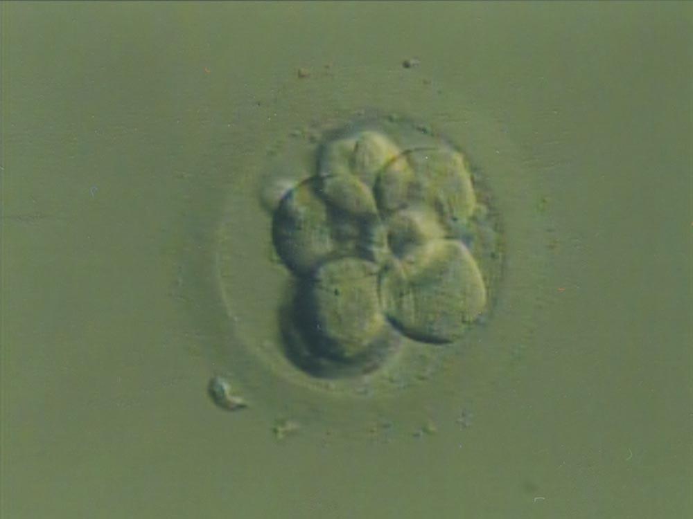 12 minute Watch embryo