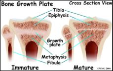 Background Differences in child and adult tibia Epiphyseal growth plates at proximal and distal ends of bone Involved in growth spurt during