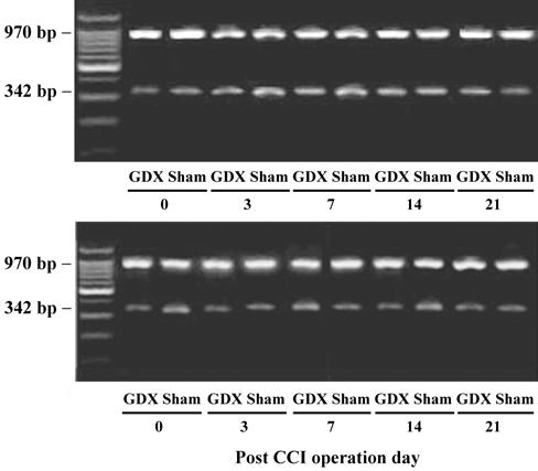 289 Fig 1. GDX inhibited BDNF mrna increase in ipsilateral (A) and contralateral (B) DRGs after CCI surgery. Total RNA of DRGs was extracted and BDNF mrna was co-amplified with GAPDH by RT-PCR.