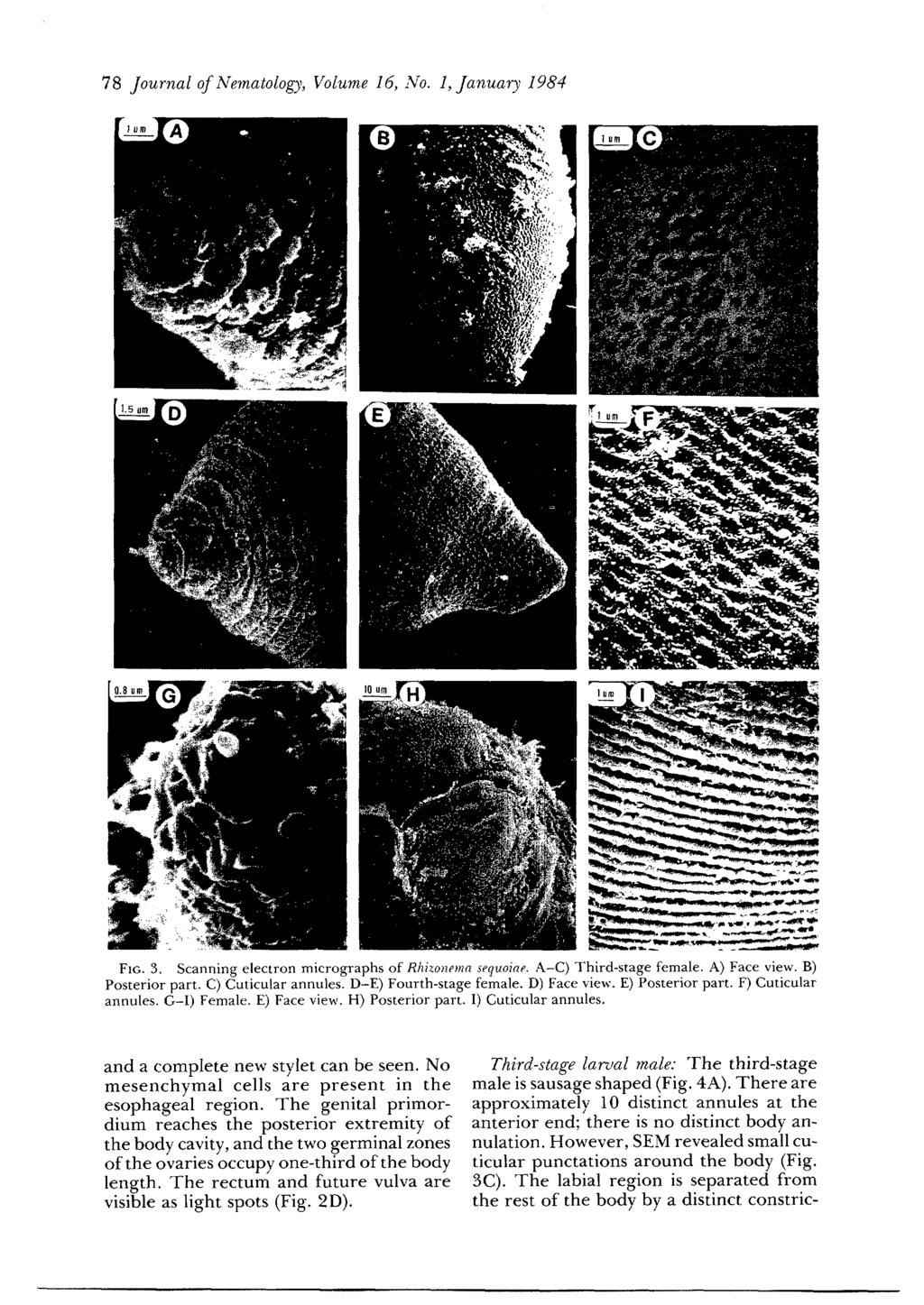 78 Journal of Nematolog)~, Volume 16, 1%. 1, Januarj 1984 FIG. 3. Scanning electron micrographs of R1lizo)zr)nn srquoin~. A-C) Third-stage female. A) Face view. B) Posterior part.