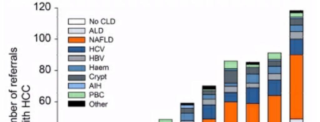 A Retrospective Study of NAFLD Associated HCC Over Time.