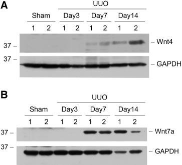 BASIC RESEARCH Figure 2. Induction of renal Wnt4 and Wnt7a protein expression after obstructive injury.