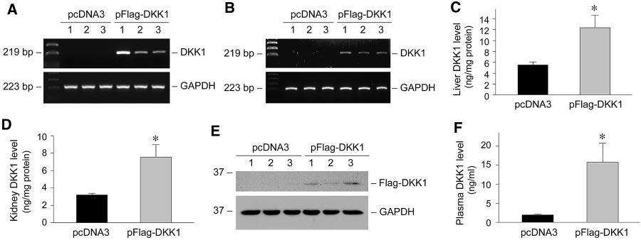 BASIC RESEARCH Figure 7. Expression of exogenous DKK1 after gene therapy.