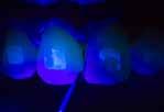 Can be exposed to loads immediately after polymerisation Fluorescent: allows for quick and gentle