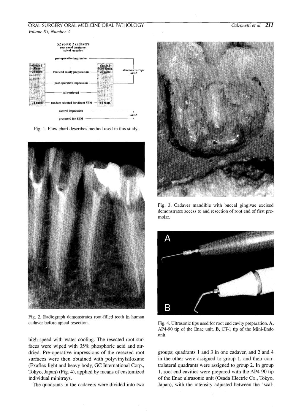 ORAL SURGERY ORAL MEDICINE ORAL PATHOLOGY Calzonetti et al. 211 Volume 85, Number 2 52 roots; 2 cadavers root canal treatment apical resection I pre-operative[ impression z "'- ~1,~.