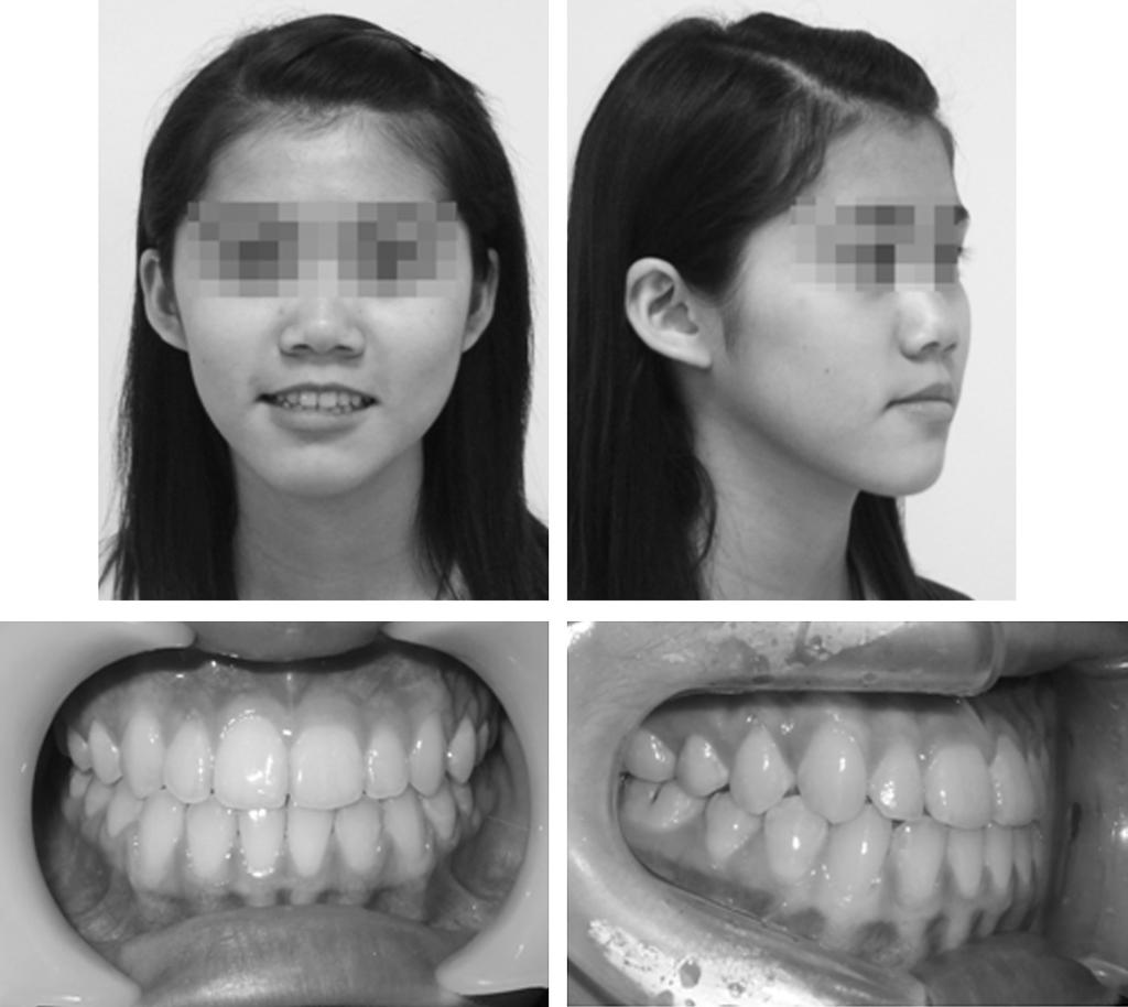 intraoral photographs.