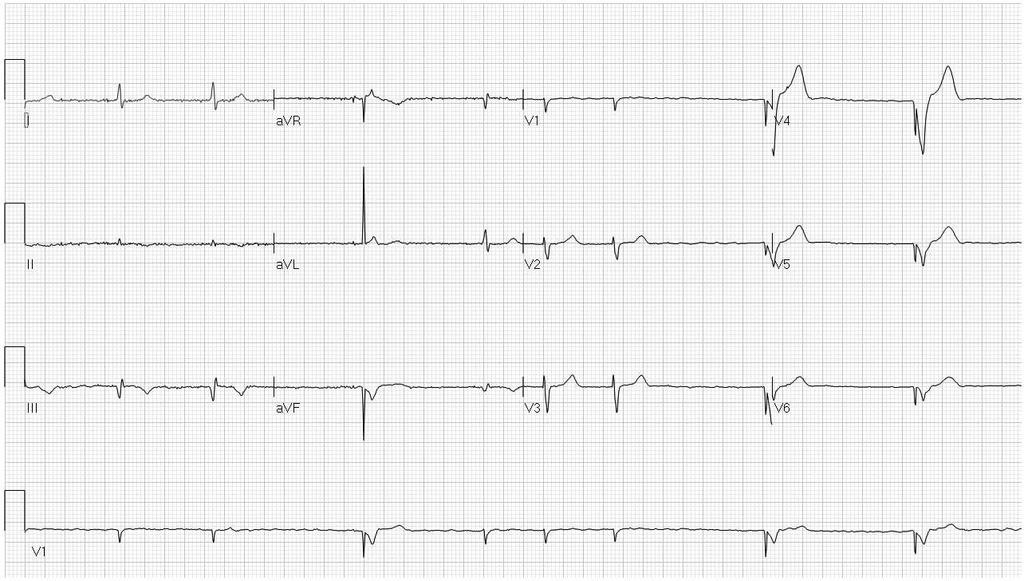 63 year old man known to the heart rhythm service. Routine assessment.